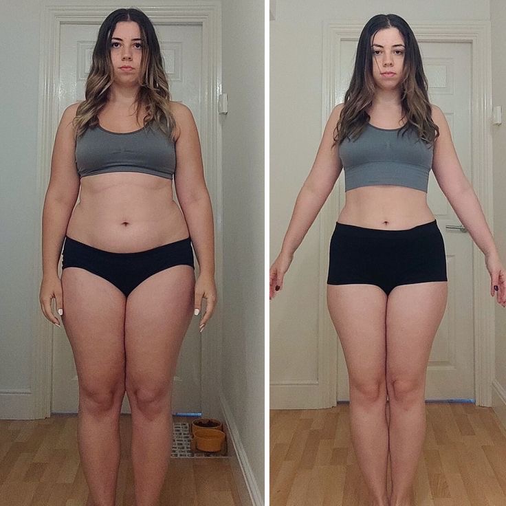 Antes e depois 1
