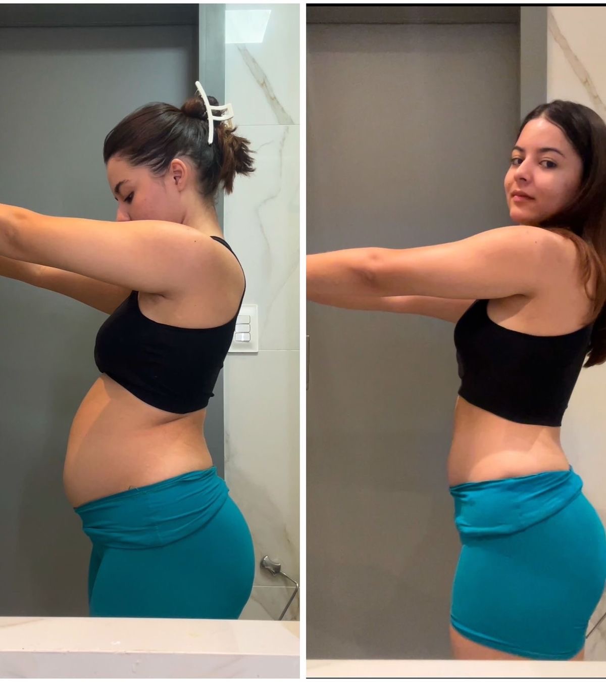 Antes e depois 3