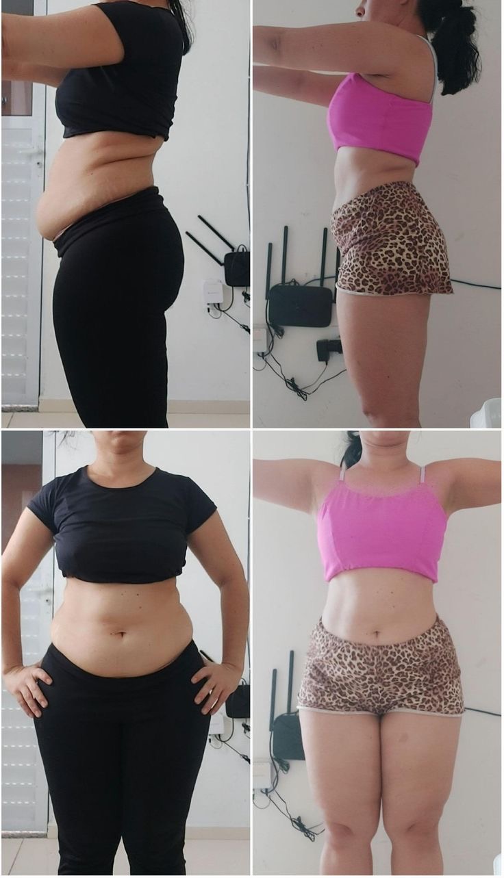 Antes e depois 4