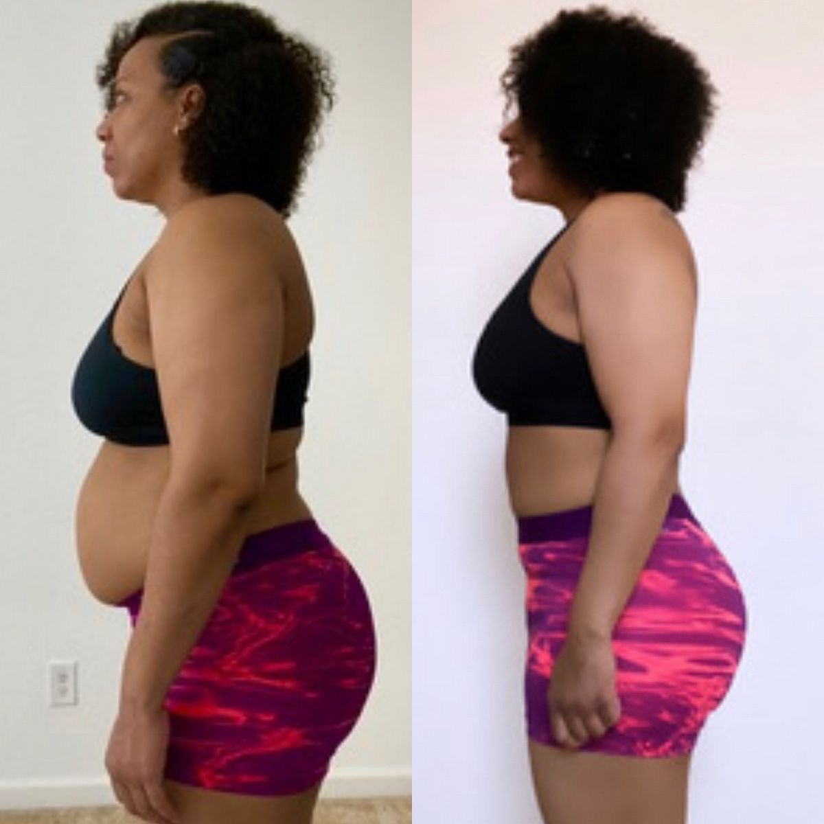 Antes e depois 5