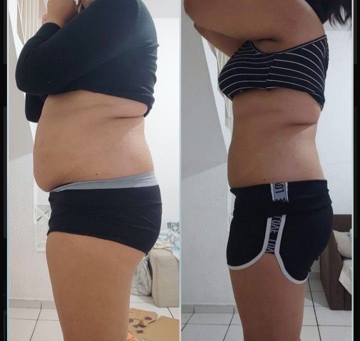 Antes e depois 6